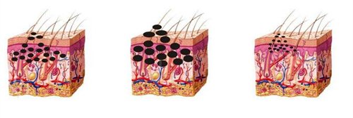 成都华美和西婵做祛斑哪个好