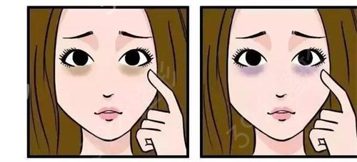 �Ϻ�ȥ�۴�����ð�