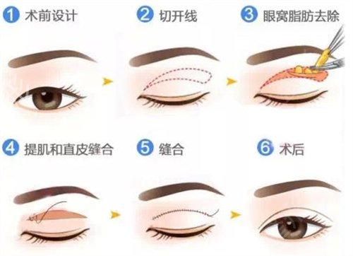 ������������ҽԺ����˫��Ƥ