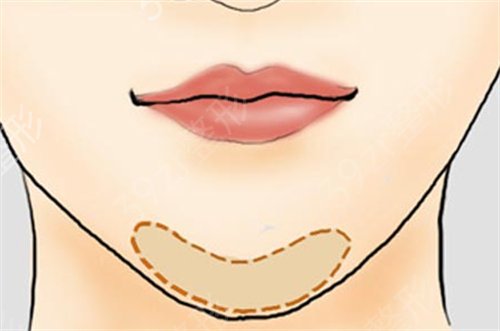 成都八大处和友谊医院磨骨哪家好