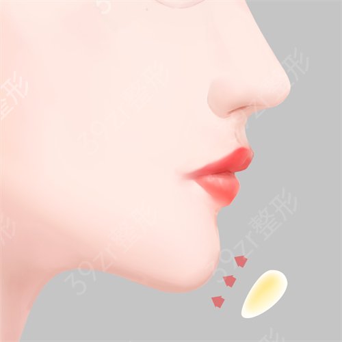 成都八大处和友谊医院磨骨哪家好