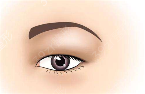 吴氏嘉美那位医生做双眼皮好