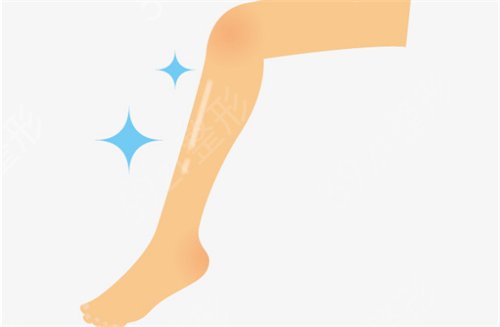 桂林哪家医院做大腿吸脂好