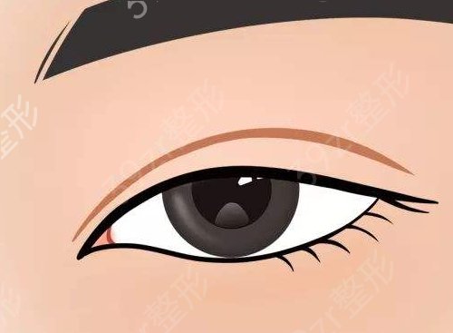 长沙三和和亚韩双眼皮哪个好