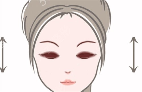 长沙三和和亚韩双眼皮哪个好