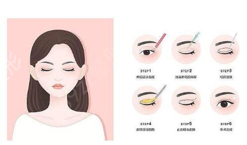 义乌整形医院排名哪家好