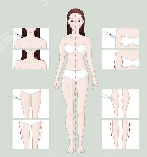 北京玉之光和禾美嘉吸脂哪个好