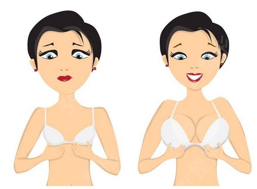 北京协和医院丰胸大概多少钱