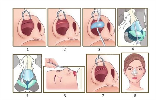 ���������ҽԺ���οƼ۸񣨷��ã��ο�_��¡�ǻָ�������ʵ��¼