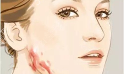 �Ϸ�ȥ��̺��ļ�ҽԺ��