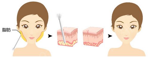 ����ĥ�������