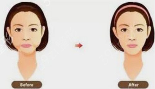 ����ĥ�������