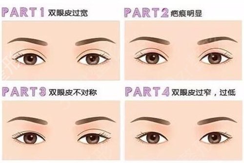 ������˫��Ƥ�õ�ҽԺ���ĸ�