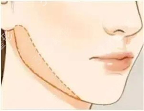 ����ĥ��˽������ҽԺ����ǰ���ع�