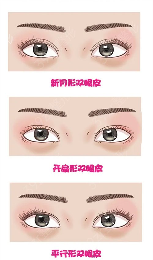 聊城割双眼皮好的正规医院排名榜推荐