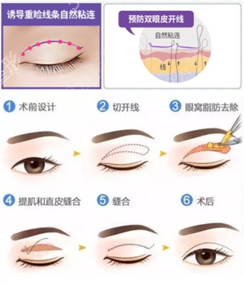 �Ͼ���������ҽԺ�������˫��ƤҲ߯Ư���˰�