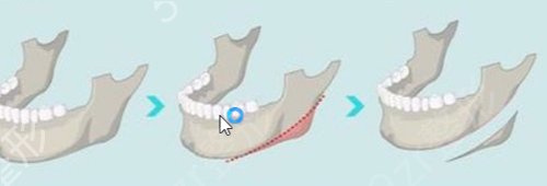 �����ļ�ĥ��ҽԺ��