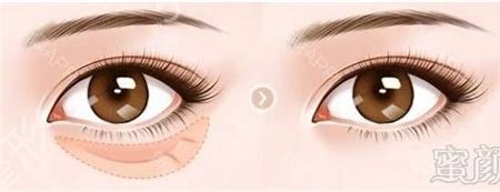 鞍山整形医院排名前三