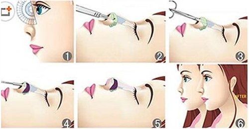 石家庄隆鼻好的整形医院排名