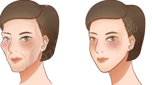 �ɶ�֬�����ר��ǰ������