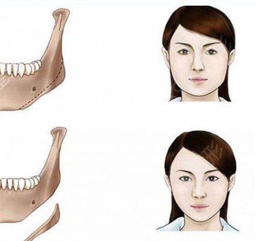 �Ϻ��ۻ�ҽԺ��ĥ��������