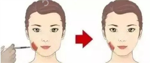 珠海十佳整形医院排名榜前四口碑点评