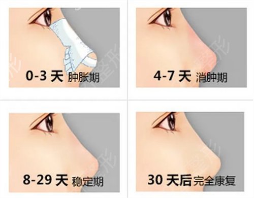 杭州新友好整形医院怎么样