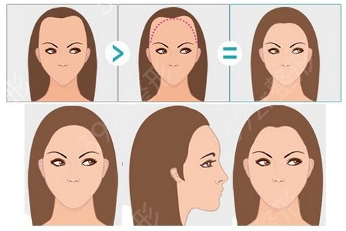 ����ֲ������ҽԺ������Ϯ