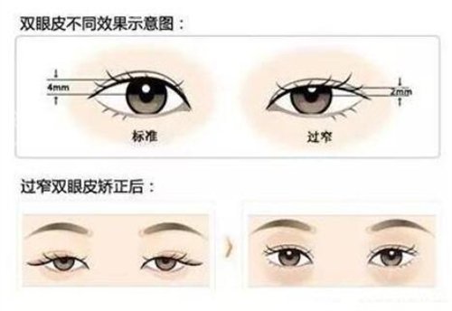 苏州眼睛修复医院哪里好