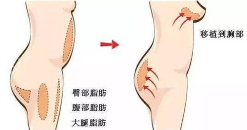 全国口碑好的隆胸专家排行榜列表前五发布