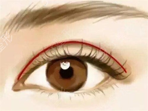 ����һԺ���ο�˫��Ƥ˭���ĺ�