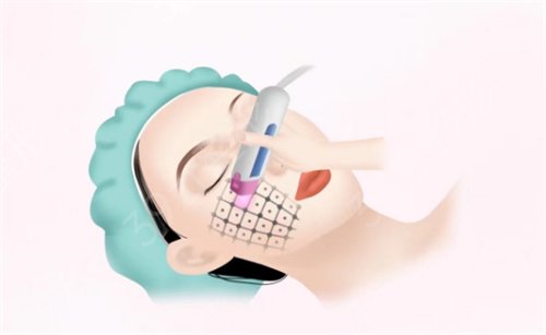 西安热玛吉哪里好