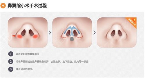 ��ɳ¡�ǱȽϳ�����ҽԺǰ������