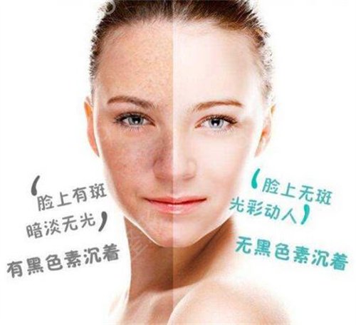 ���������󹬼�������