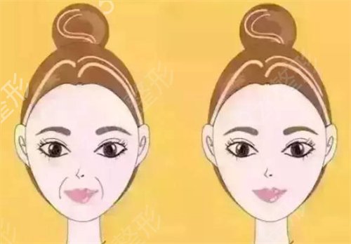 �������沿����������