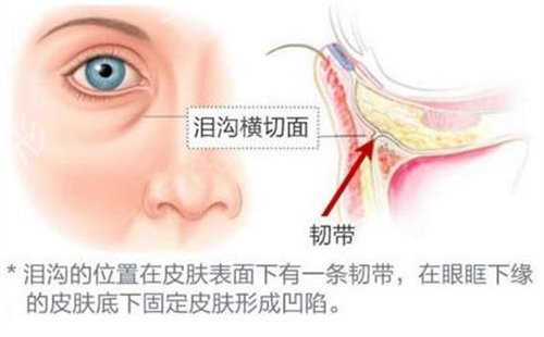 烟台割双眼皮哪家医院比较好