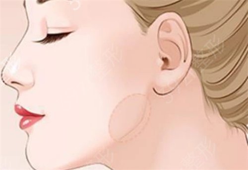 ��ҽ����Ժ���������ô��