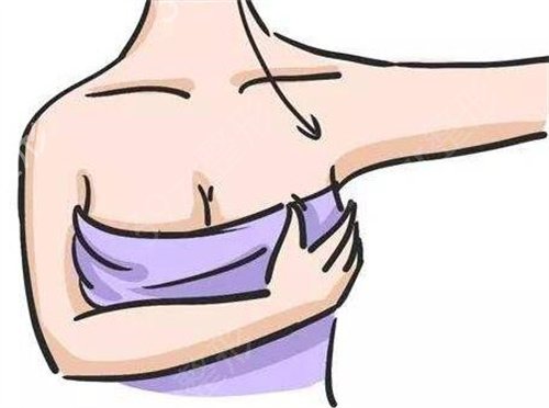 南京鼓楼医院整形科隆胸价格表