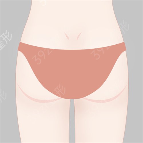 成都艺星吸脂怎么样_价格表(价目表)_瘦大腿案例果图_成都艺星整形项目收费明细