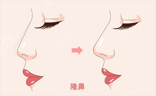 成都三甲整形医院排名(公立版)新鲜出炉