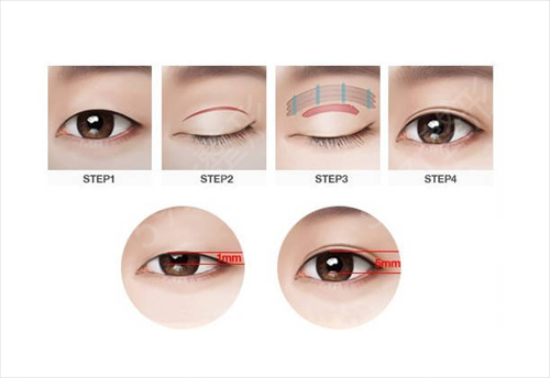 ���ݸ�˫��ƤҽԺ������2022�淢��_�Ƽ�ҽ���Ͱ����ο�