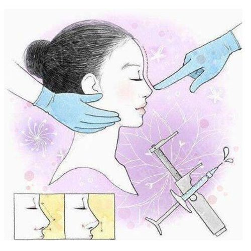 太原华美隆鼻怎么样