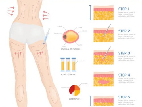 ��������֬�ĸ�ҽԺ��