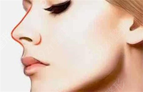 �ڹ���������˹轺¡��