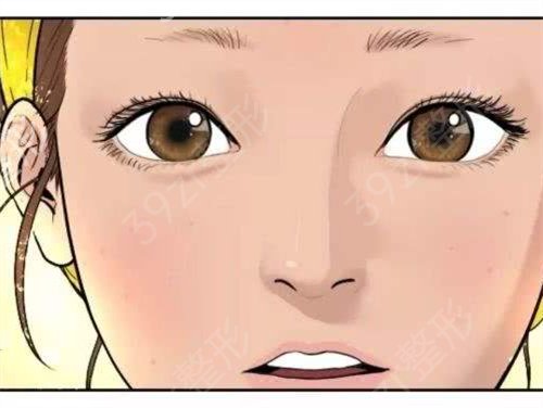 长沙三和整形医院割双眼皮怎样