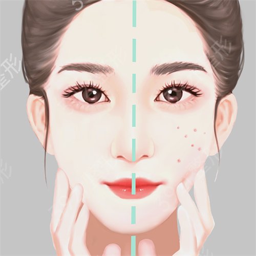 哪里做光子嫩肤好