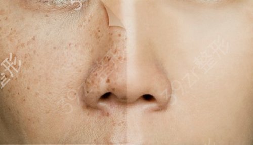 甘肃省人民医院整形科概况_收费信息_怎么样