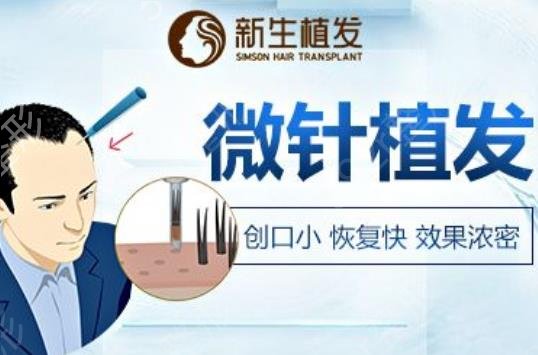 深圳植发医院排名前十2022