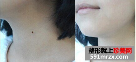 ����ȥ�����Ǯ ����ȥ�밸��