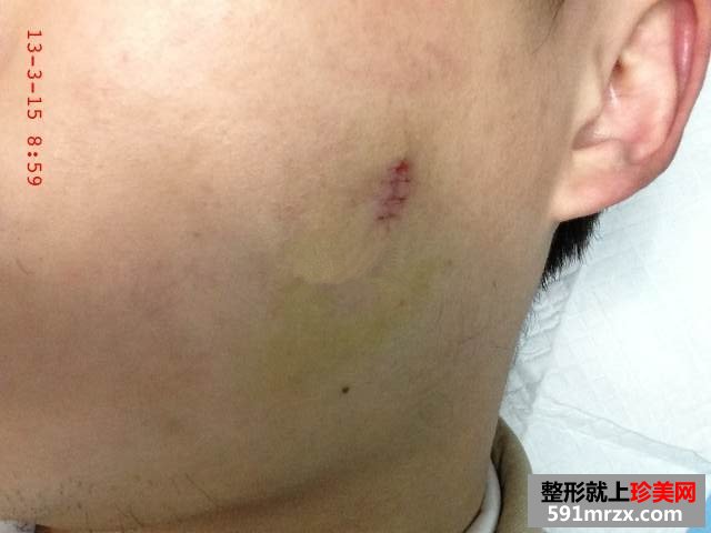 ����ȥ�����Ǯ ����ȥ�밸��